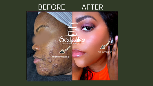 SoulPhlex Face and Body Bar